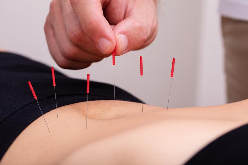 Acupuncture may reduce dyspepsia symptoms